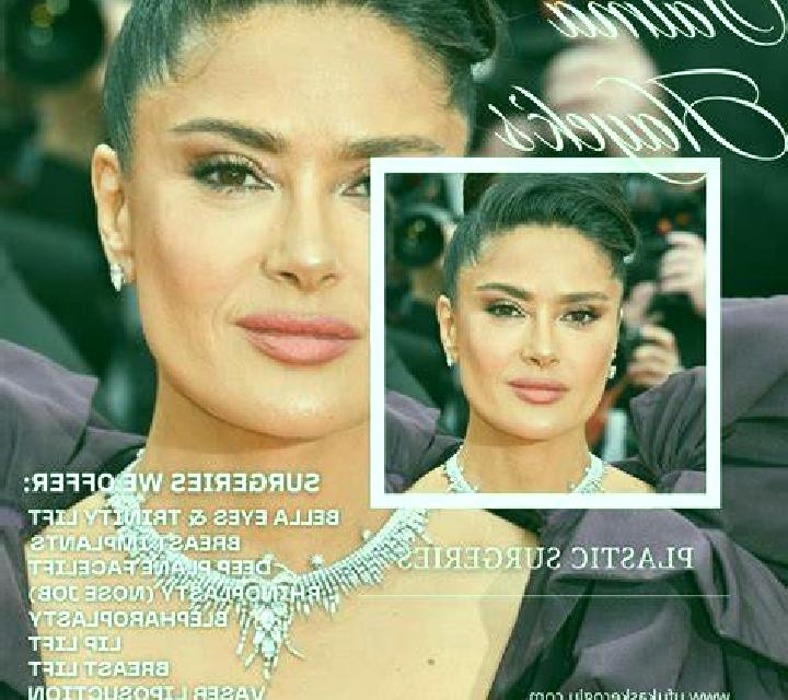 Rosa 3 Zumarraga escort